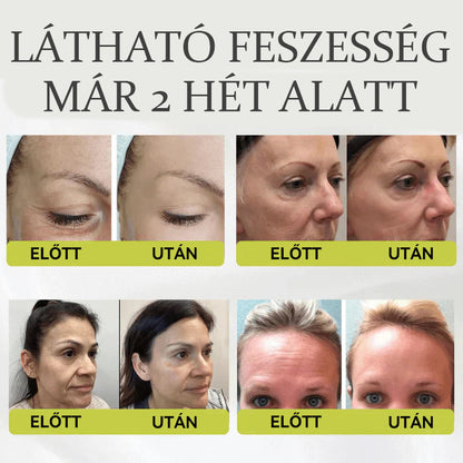 🏆 Büszkén az Európai Unióban gyártva 💫 Tiworld® fejlett peptid Botox-hatású + Vita-A retinol feszesítő megújító krém – ma csak 70% KEDVEZMÉNNYEL