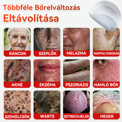 🔥 GFOUK® Mikrotűs növényi bőrkinövés eltávolító tapasz