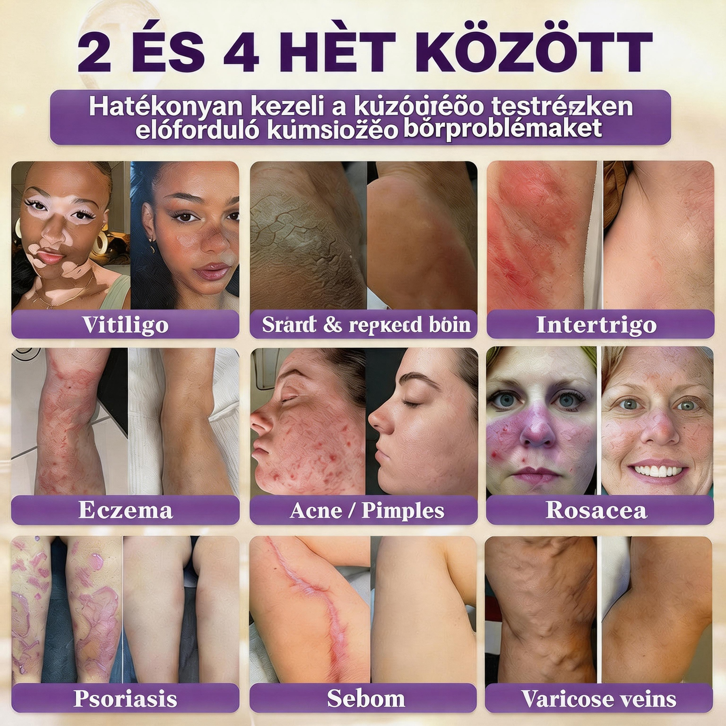 🍁QIAWI® Biotin 10 az 1-ben bőrregeneráló krém – Magyarországon készült és Magyarországról szállítva – Utolsó napi akció: 75% KEDVEZMÉNY