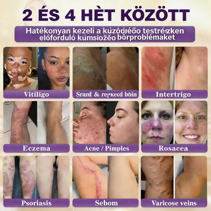 🍁QIAWI® Biotin 10 az 1-ben bőrregeneráló krém – Magyarországon készült és Magyarországról szállítva – Utolsó napi akció: 75% KEDVEZMÉNY