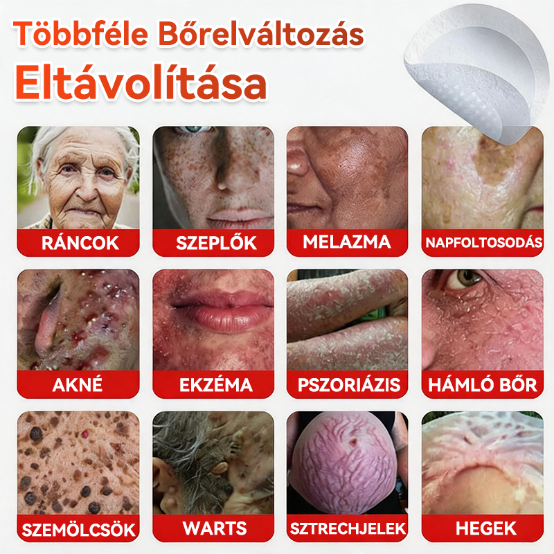 🏆🏆GFOUK® Mikrotűs növényi bőrkinövés eltávolító tapasz