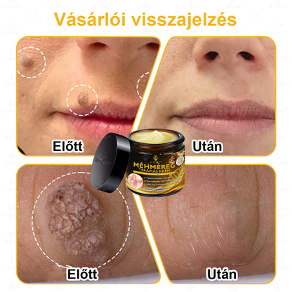 🐝🌿Hivatalos Bolt: 🏆RTSSKE™ Méh Méreg Bőrápoló Krém