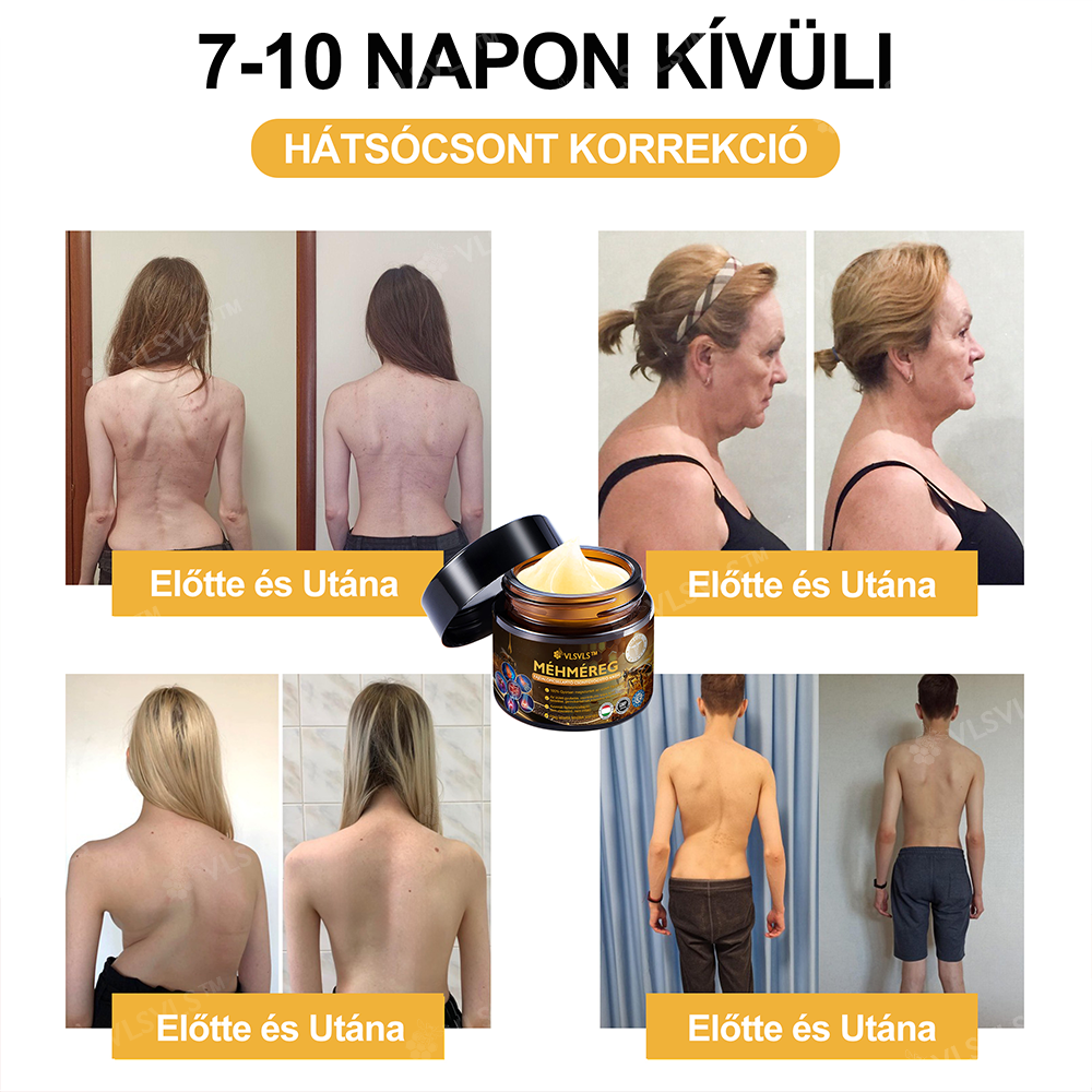 🔥Már csak 5 doboz maradt! További 70% kedvezményt biztosítunk! Legyen fitt és egészséges. Ha most veszít, csak jövőre lesz esélye.