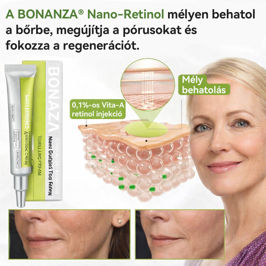 🏆 Büszkén az Európai Unióban gyártva 💫 Tiworld® fejlett peptid Botox-hatású + Vita-A retinol feszesítő megújító krém – ma csak 70% KEDVEZMÉNNYEL