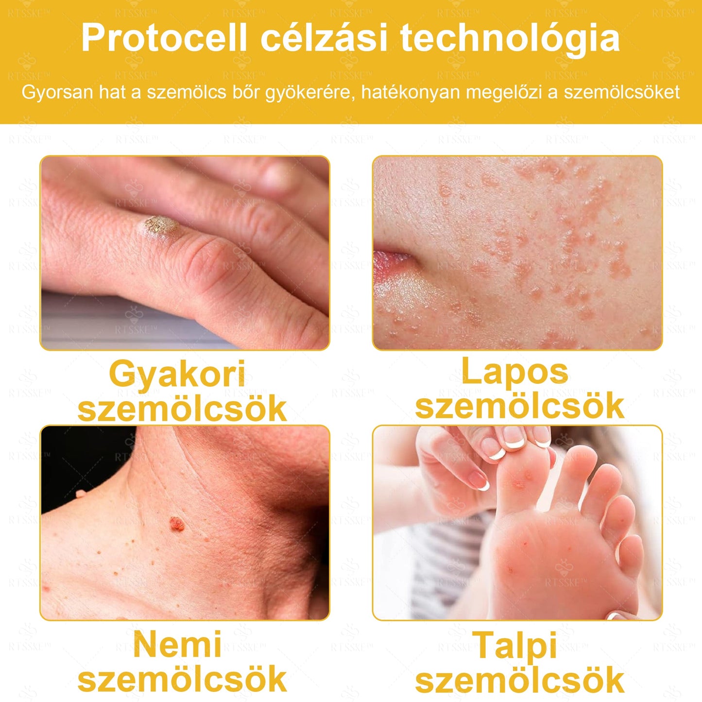 🐝🌿Hivatalos Bolt: 🏆RTSSKE™ Méh Méreg Bőrápoló Krém