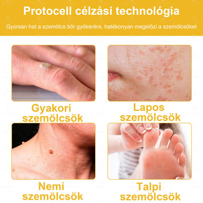 🐝🌿Hivatalos Bolt: 🏆RTSSKE™ Méh Méreg Bőrápoló Krém