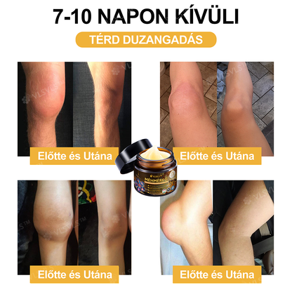 🔥Már csak 5 doboz maradt! További 70% kedvezményt biztosítunk! Legyen fitt és egészséges. Ha most veszít, csak jövőre lesz esélye.