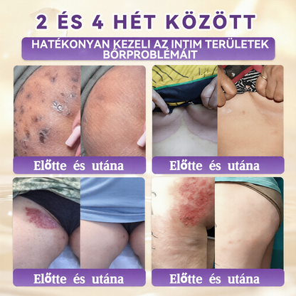 🍁QIAWI® Biotin 10 az 1-ben bőrregeneráló krém – Magyarországon készült és Magyarországról szállítva – Utolsó napi akció: 75% KEDVEZMÉNY