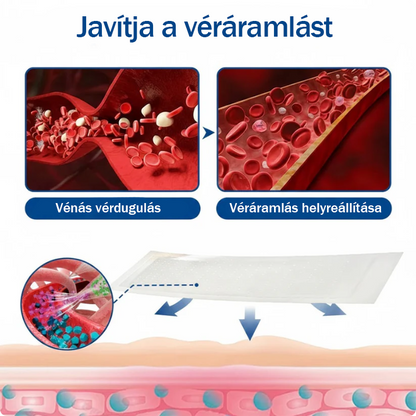 🇭🇺👨‍⚕️✅TAILEDEN® VeinEase Mikrotűs Kezelő Tapasz⚡Azonnali Megkönnyebbülés, Hosszú Távú Eredmények