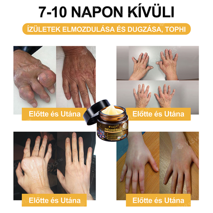 🔥Már csak 5 doboz maradt! További 70% kedvezményt biztosítunk! Legyen fitt és egészséges. Ha most veszít, csak jövőre lesz esélye.