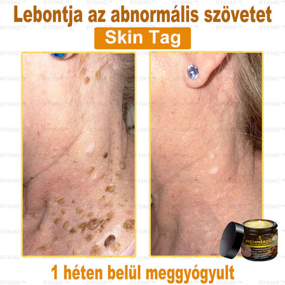 匈牙利🎖️ RTSSKE™ Méhméreg Teljeskörű Bőrápoló Krém 🇺🇸 Bőrgyógyászok Ajánlják