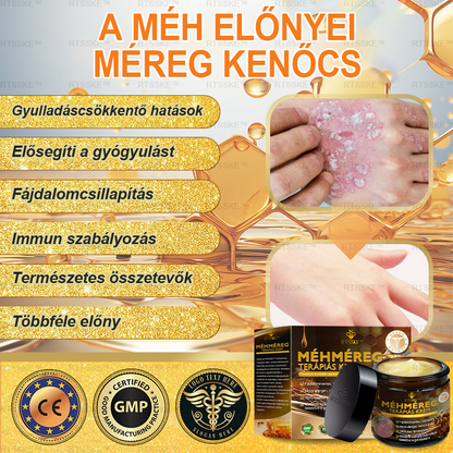 匈牙利🌿🌿RTSSKE™ Méhméreg Haladó Psoriasis Kezelő Krém (👨‍⚕Orvos Által Ajánlott)