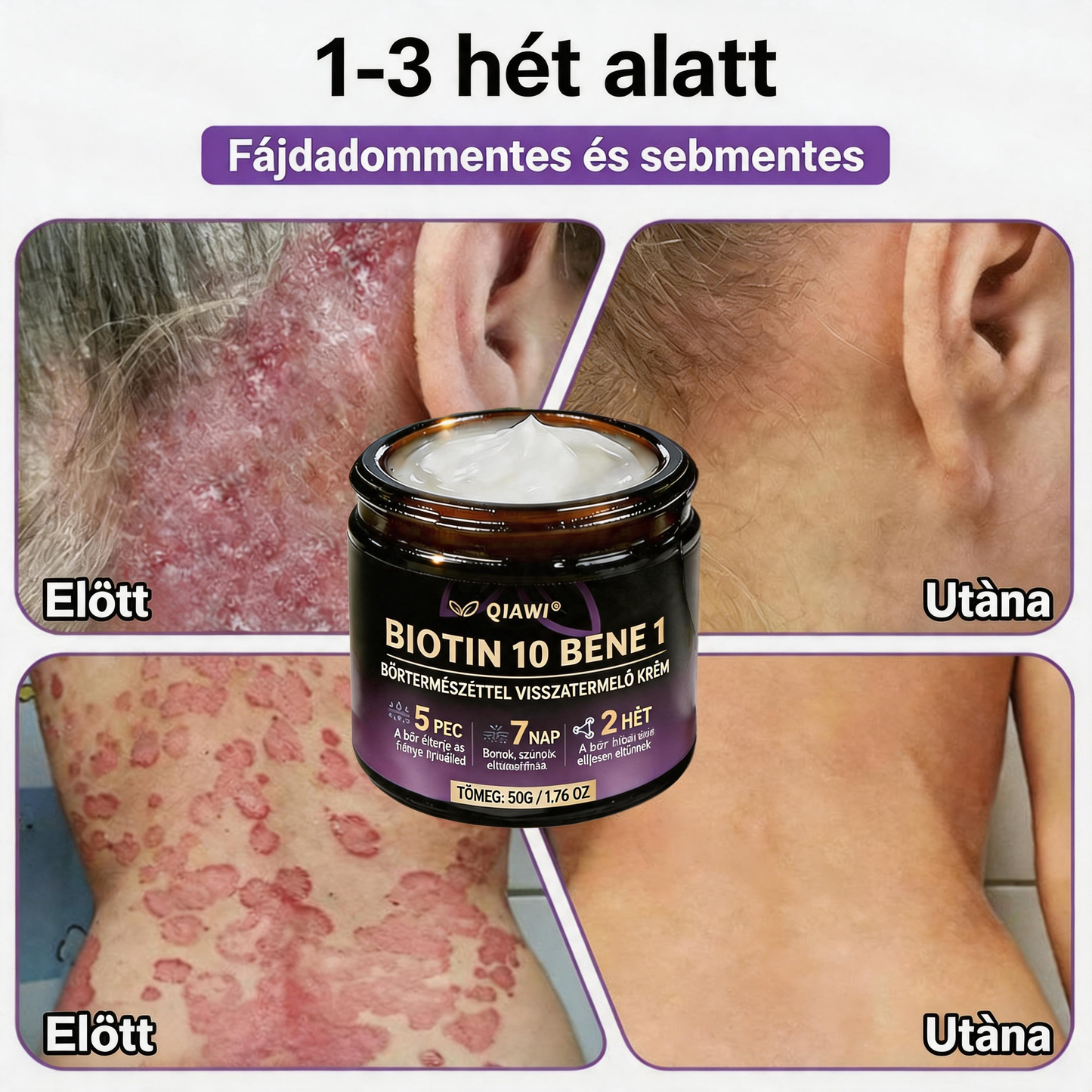 🍁QIAWI® Biotin 10 az 1-ben bőrregeneráló krém – Magyarországon készült és Magyarországról szállítva – Utolsó napi akció: 75% KEDVEZMÉNY