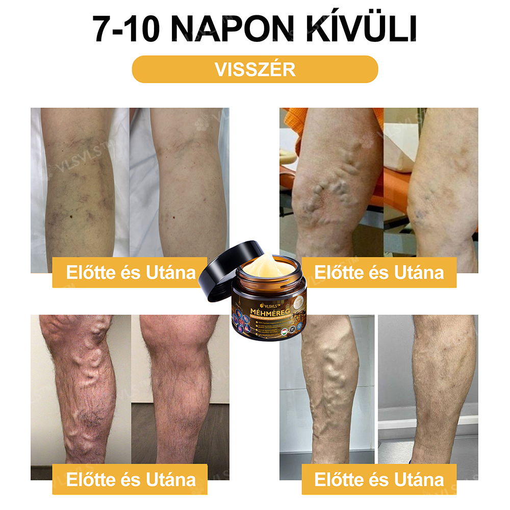 🔥Már csak 5 doboz maradt! További 70% kedvezményt biztosítunk! Legyen fitt és egészséges. Ha most veszít, csak jövőre lesz esélye.