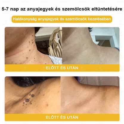 🐝🌿Hivatalos Bolt: 🏆RTSSKE™ Méh Méreg Bőrápoló Krém