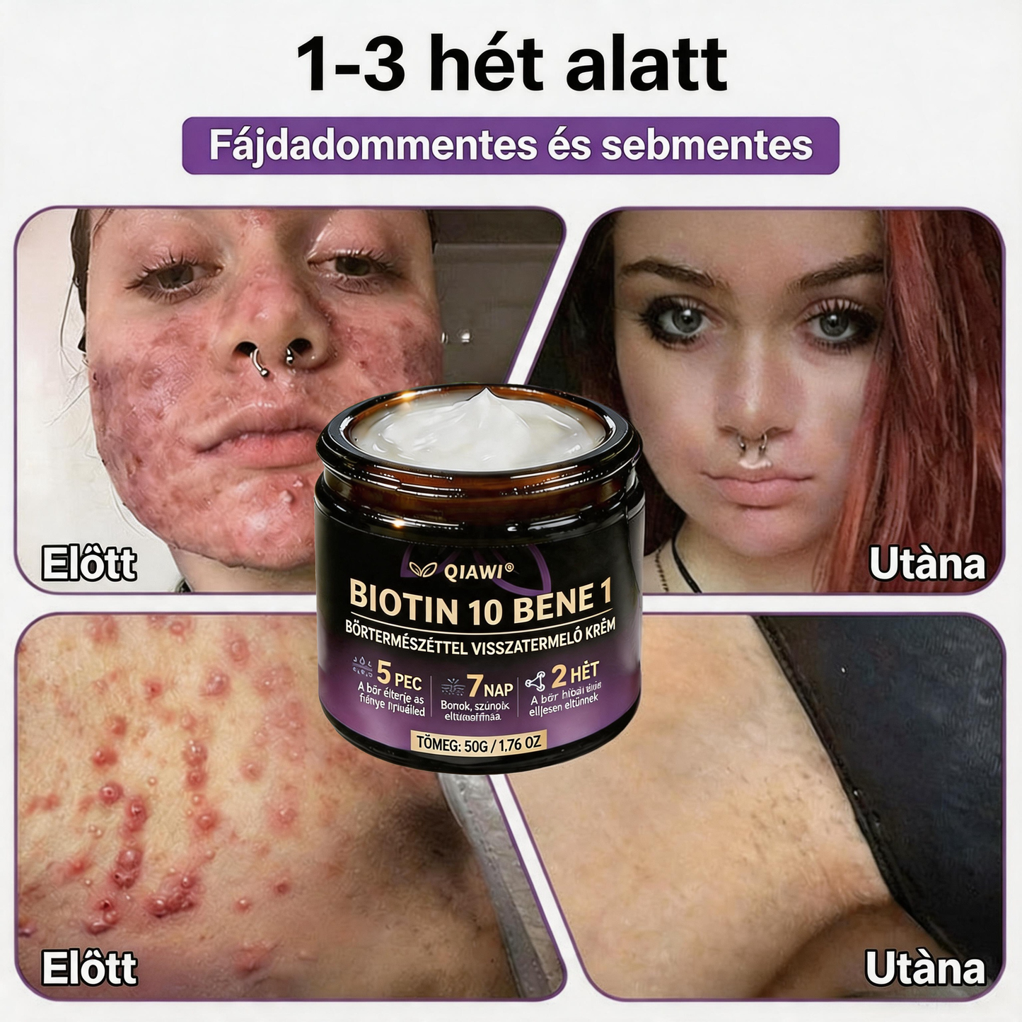 🍁QIAWI® Biotin 10 az 1-ben bőrregeneráló krém – Magyarországon készült és Magyarországról szállítva – Utolsó napi akció: 75% KEDVEZMÉNY