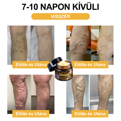 VLSVLS™ Méhméreg Azonnali Ultra Erős Fájdalomcsillapító Krém - (Enyhíti a fájdalmat ízületi gyulladás, izomfájdalom, hátfájás, térdek, hát, vállak, csípők, csuklók, kezek esetén)