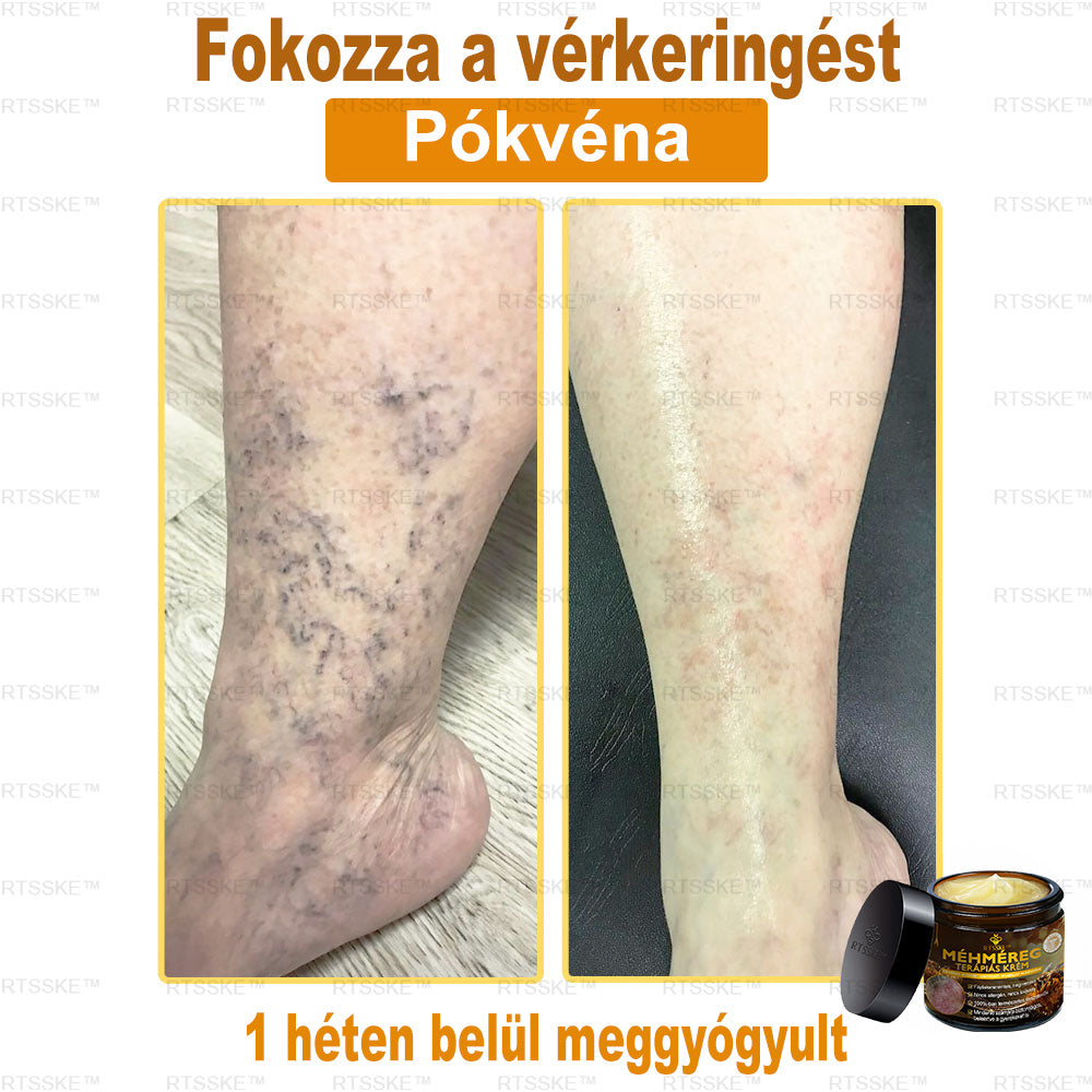 匈牙利🎖️ RTSSKE™ Méhméreg Teljeskörű Bőrápoló Krém 🇺🇸 Bőrgyógyászok Ajánlják