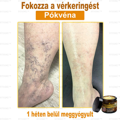 匈牙利🎖️ RTSSKE™ Méhméreg Teljeskörű Bőrápoló Krém 🇺🇸 Bőrgyógyászok Ajánlják