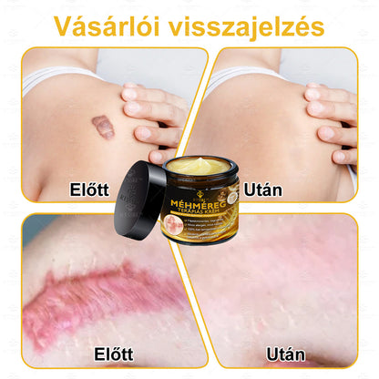 🐝🌿Hivatalos Bolt: 🏆RTSSKE™ Méh Méreg Bőrápoló Krém