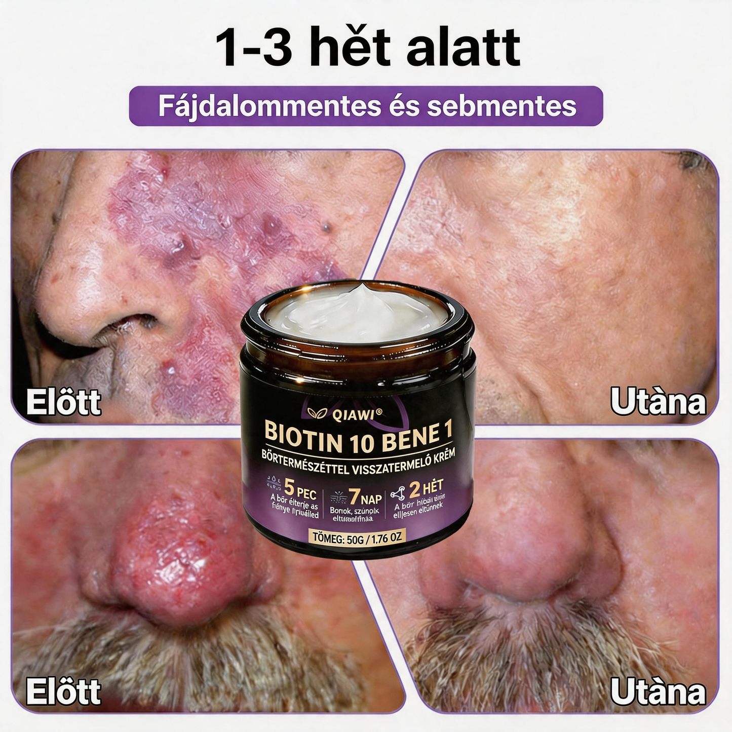 🍁QIAWI® Biotin 10 az 1-ben bőrregeneráló krém – Magyarországon készült és Magyarországról szállítva – Utolsó napi akció: 75% KEDVEZMÉNY
