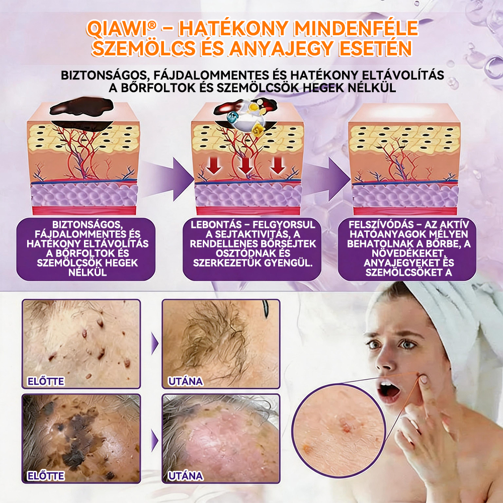 🍁QIAWI® Biotin 10 az 1-ben bőrregeneráló krém – Magyarországon készült és Magyarországról szállítva – Utolsó napi akció: 75% KEDVEZMÉNY