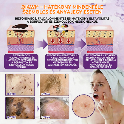 🍁QIAWI® Biotin 10 az 1-ben bőrregeneráló krém – Magyarországon készült és Magyarországról szállítva – Utolsó napi akció: 75% KEDVEZMÉNY