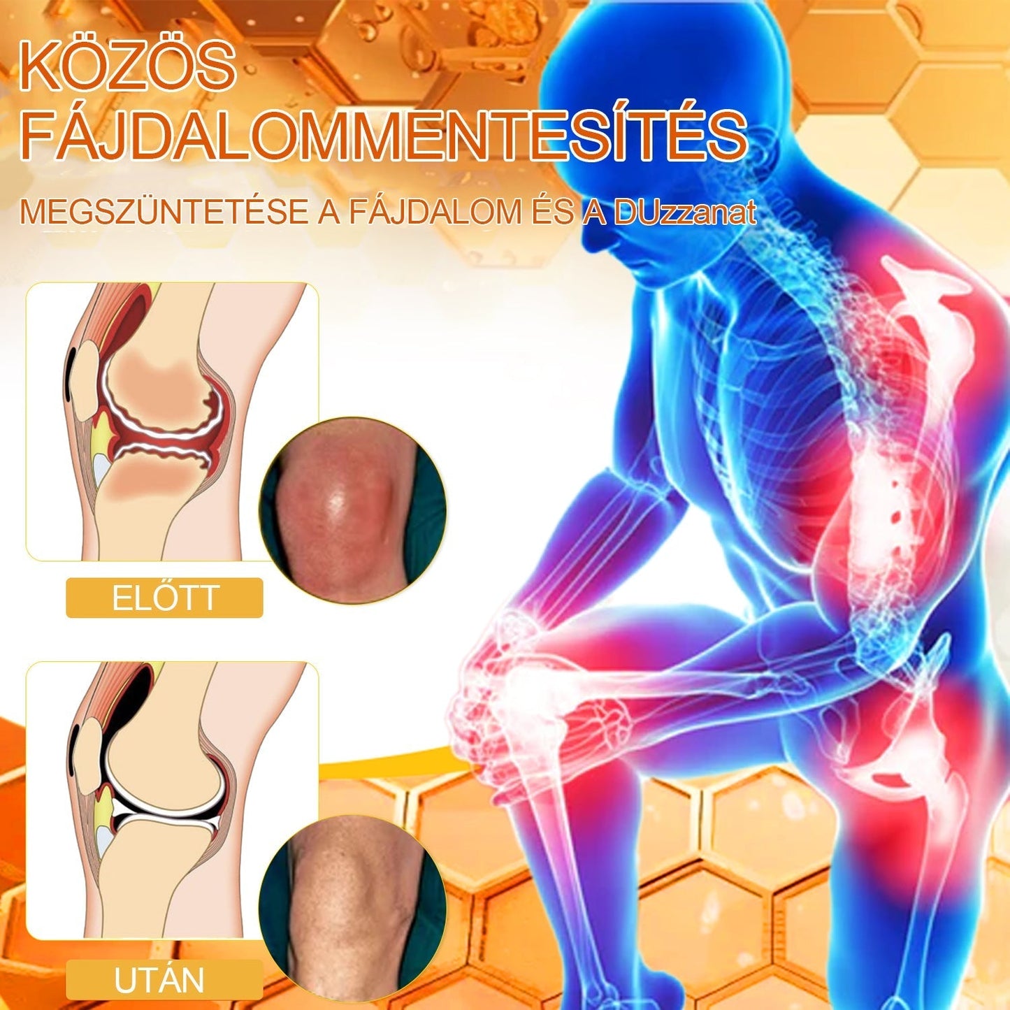 🔥Már csak 5 doboz maradt! További 70% kedvezményt biztosítunk! Legyen fitt és egészséges. Ha most veszít, csak jövőre lesz esélye.